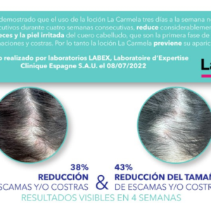 La Carmela - antes y cespues de los problemas del cuero cabelludo.